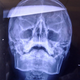 Illustration for article titled Accused Game Cheater Gets Knife Through Head and Survives